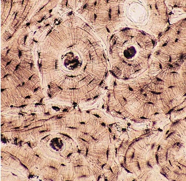 Bone Connective Tissue Under Microscope
